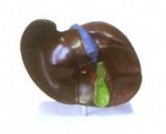 Model of liver gallstones